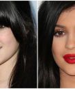 Kylie Jenner  Dudak Dolgusu Öncesi ve Sonrası